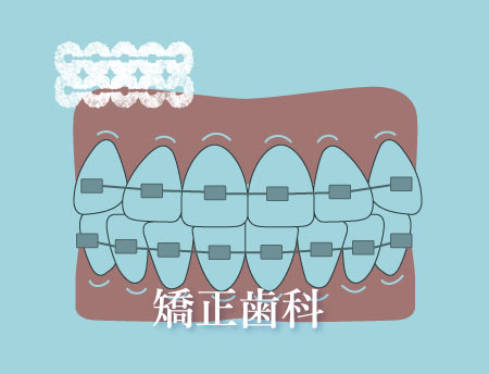 矯正歯科